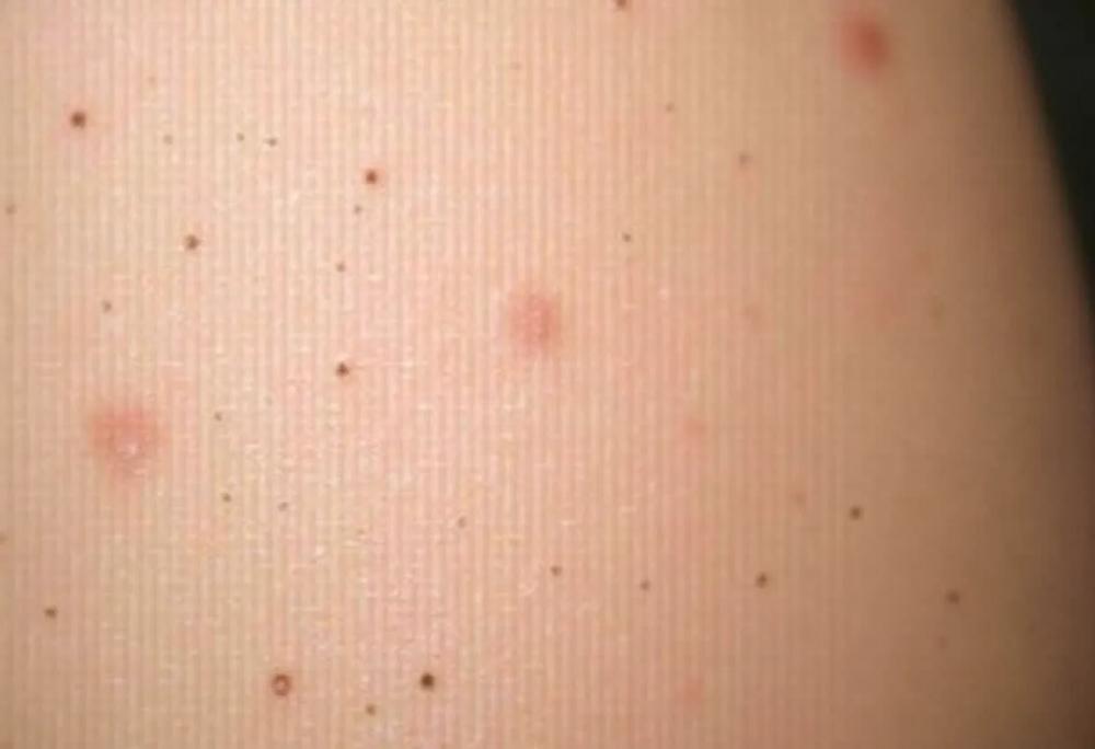 Skin texture