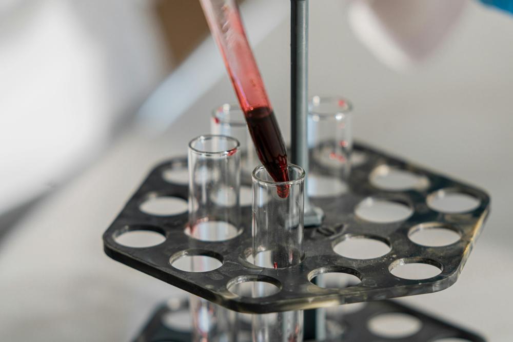 blood analysis